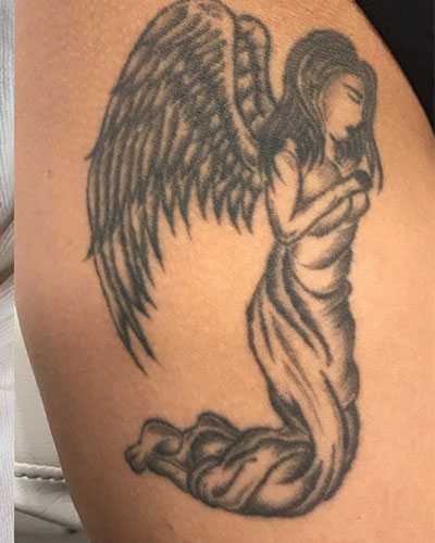 Tattoo Removal Before After